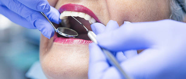 Best Broken or Cracked Tooth Emergency Dentist in Apopka, FL